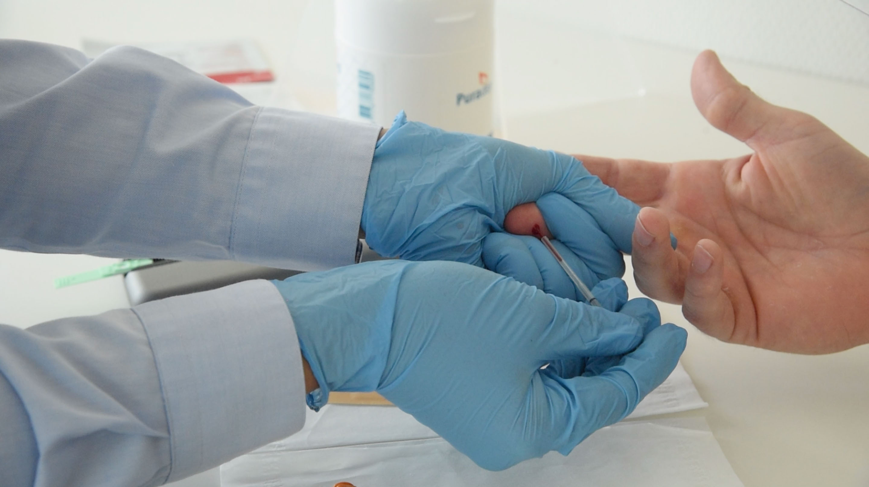 Vingerprik Vingerprik